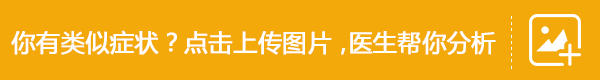 白癜风“表皮移植治疗基金援助”,11月15—30日正式启动 白癜风“表皮移植治疗基金援助”,11月15—30日正式启动